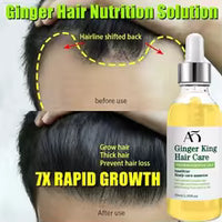 Ginger for Hair Care—Achieve Healthy, Thick Hair.