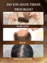 Ginger for Hair Care—Achieve Healthy, Thick Hair.