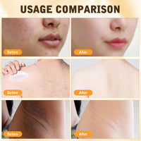 HOUKEA - Bee Venom Skin Care Cream