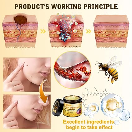 HOUKEA - Bee Venom Skin Care Cream